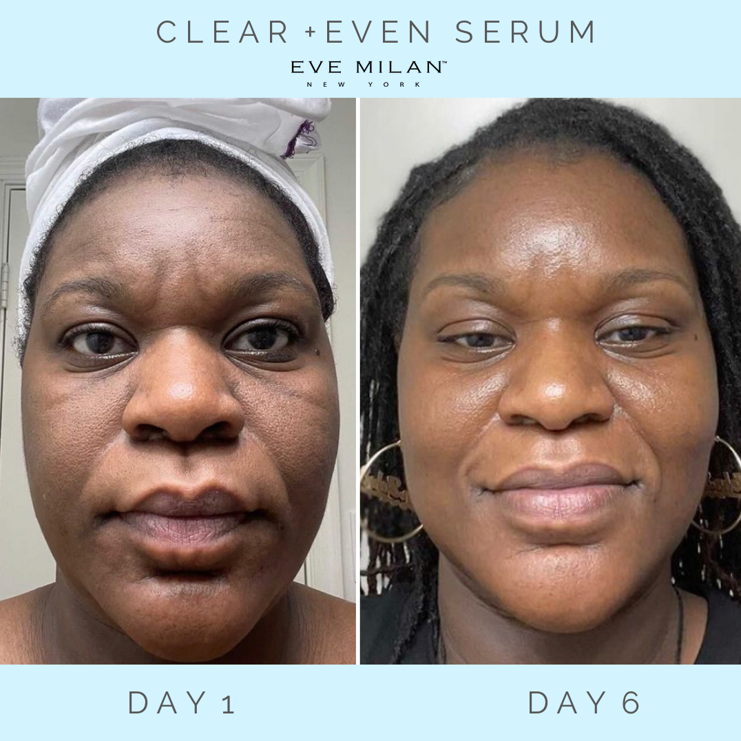 Clear + Even Serum